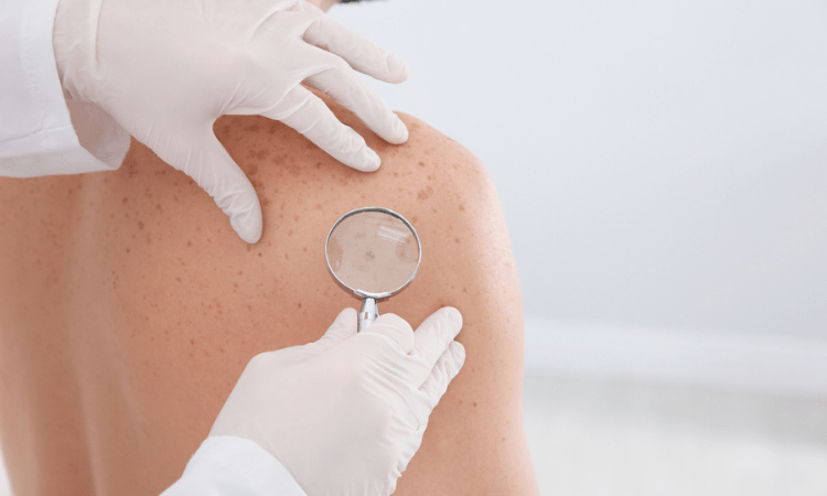 Dermatología
